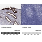 Anti-TGM4 Antibody