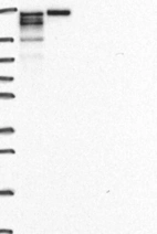 Anti-CDK12 Antibody