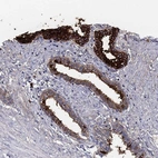 Immunohistochemical staining of human prostate shows high expression.