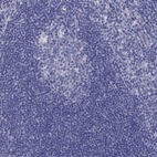 Anti-TGM4 Antibody