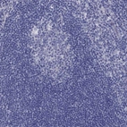 Immunohistochemical staining of human tonsil shows low expression as expected.