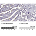 Anti-KIF19 Antibody