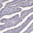 Immunohistochemical staining of human fallopian tube shows high expression.