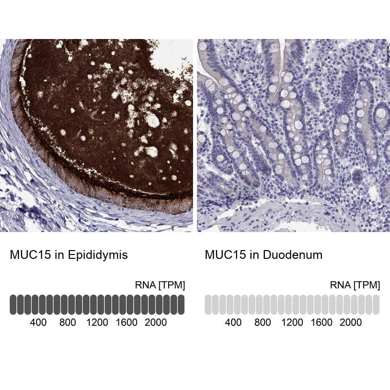 Anti-MUC15 Antibody