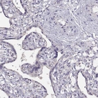 Immunohistochemical staining of human placenta shows low expression as expected.