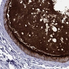 Immunohistochemical staining of human epididymis shows high expression.