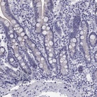 Anti-MUC15 Antibody
