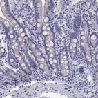 Immunohistochemical staining of human duodenum shows low expression as expected.