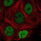 Anti-FAM240C Antibody