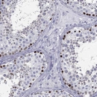 Anti-ESX1 Antibody