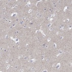 Immunohistochemical staining of human cerebral cortex shows high expression.