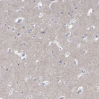 Immunohistochemical staining of human cerebral cortex shows high expression.
