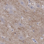 Immunohistochemical staining of human hippocampus shows cytoplasmic positivity in neuropil.