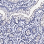 Immunohistochemical staining of human duodenum shows low expression as expected.
