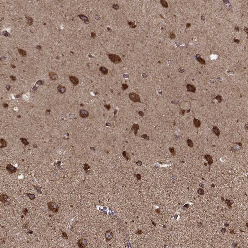 Anti-AGPAT1 Antibody