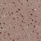 Anti-AGPAT1 Antibody