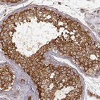 Immunohistochemical staining of human testis shows strong cytoplasmic positivity in cells in seminiferous ducts.