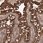 Immunohistochemical staining of human duodenum shows strong cytoplasmic positivity in glandular cells.