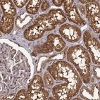 Immunohistochemical staining of human kidney shows strong cytoplasmic positivity in cells in tubules.