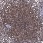 Immunohistochemical staining of human spleen shows strong membranous positivity in cells in white pulp.