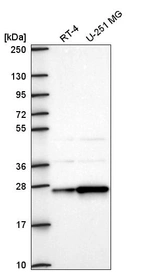 Western blot analysis in human cell line RT-4 and human cell line U-251 MG.