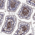 Immunohistochemical staining of human small intestine shows strong membranous positivity in lymphoid cells.