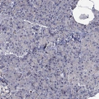 Immunohistochemical staining of human pancreas shows no positivity in exocrine glandular cells as expected.