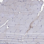 Immunohistochemical staining of human skeletal muscle shows no positivity in myocytes as expected.
