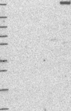 Lane 1: Marker [kDa] 250, 130, 95, 72, 55, 36, 28, 17, 10 | Lane 2: RT4 | Lane 3: U-251 MG | Lane 4: Human Plasma | Lane 5: Liver | Lane 6: Tonsil