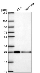 Western blot analysis in human cell line RT-4 and human cell line U-251 MG.