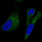 Anti-UFD1L Antibody