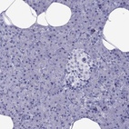 Immunohistochemical staining of human pancreas shows low expression as expected.