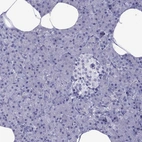 Immunohistochemical staining of human pancreas shows low expression as expected.