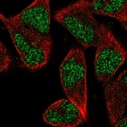 Anti-ZNF627 Antibody