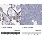 Anti-GCM1 Antibody
