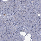 Immunohistochemical staining of human pancreas shows low expression as expected.