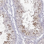 Immunohistochemical staining of human testis shows high expression.