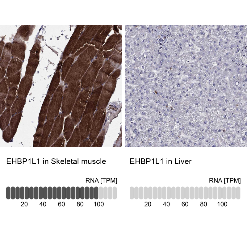 Anti-EHBP1L1 Antibody