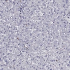 Immunohistochemical staining of human liver shows low expression as expected.