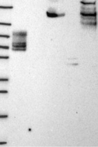 Lane 1: Marker [kDa] 250, 130, 95, 72, 55, 36, 28, 17, 10 | Lane 2: RT4 | Lane 3: U-251 MG | Lane 4: Human Plasma | Lane 5: Liver | Lane 6: Tonsil