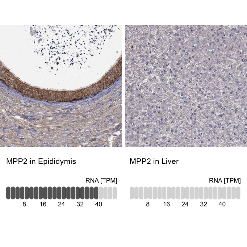 Anti-MPP2 Antibody