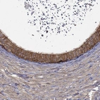 Immunohistochemical staining of human epididymis shows high expression.