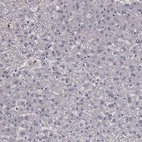 Immunohistochemical staining of human liver shows low expression as expected.