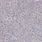 Immunohistochemical staining of human liver shows low expression as expected.