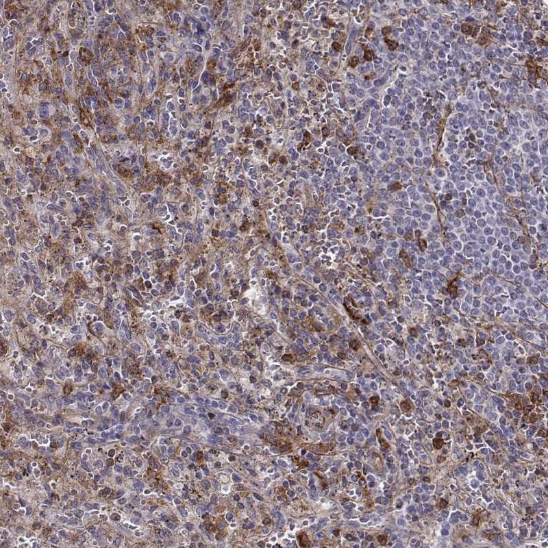 Anti-ZYX Antibody