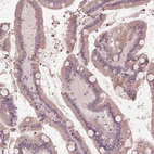 Anti-ANKLE1 Antibody