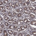 Anti-RPLP0 Antibody