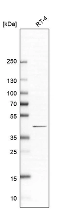 Anti-PAQR6 Antibody