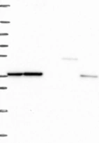 Lane 1: Marker [kDa] 250, 130, 95, 72, 55, 36, 28, 17, 10 | Lane 2: RT4 | Lane 3: U-251 MG | Lane 4: Human Plasma | Lane 5: Liver | Lane 6: Tonsil