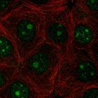 Immunofluorescent staining of human cell line MCF7 shows localization to nucleus & nucleoli.
